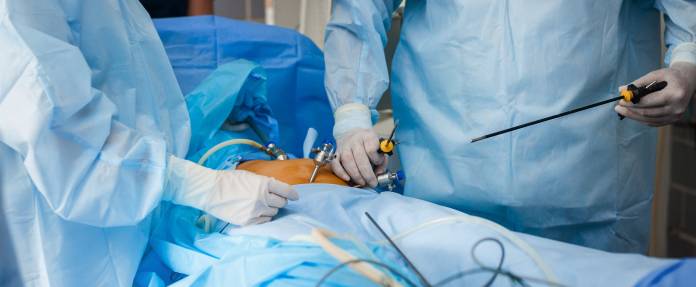 Laparoskopische Operation