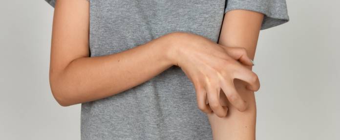 Frau, die sich am Arm kratzt