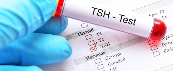 Blutprobe mit Aufschrift TSH-Test zur Untersuchung auf eine Schilddrüsenunterfunktion