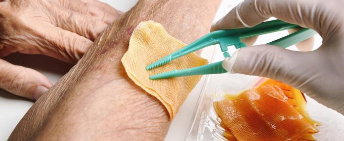 Behandlung einer Wunde mit Pinzette