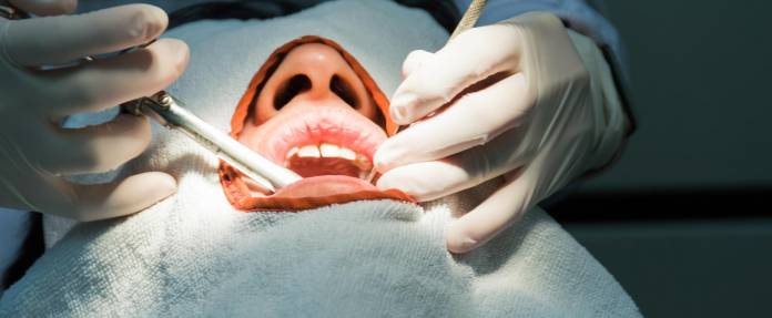 Zahnbehandlung unter Narkose
