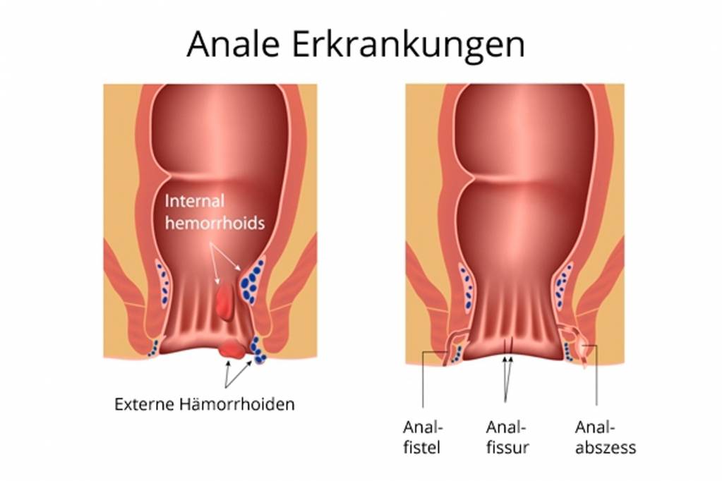 Am arsch jucken Wenn der