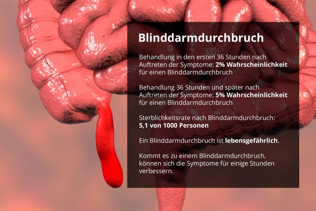 Wie Zeigt Sich Ein Blinddarmdurchbruch Und Wie Gefahrlich Ist Er Wie Zeigt Sich Ein Blinddarmdurchbruch Und Wie Gefahrlich Ist Er