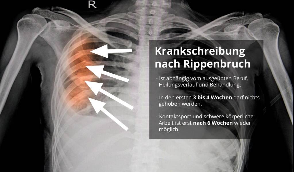 Lange wie krank op zwerchfellbruch Analvenenthrombose Op