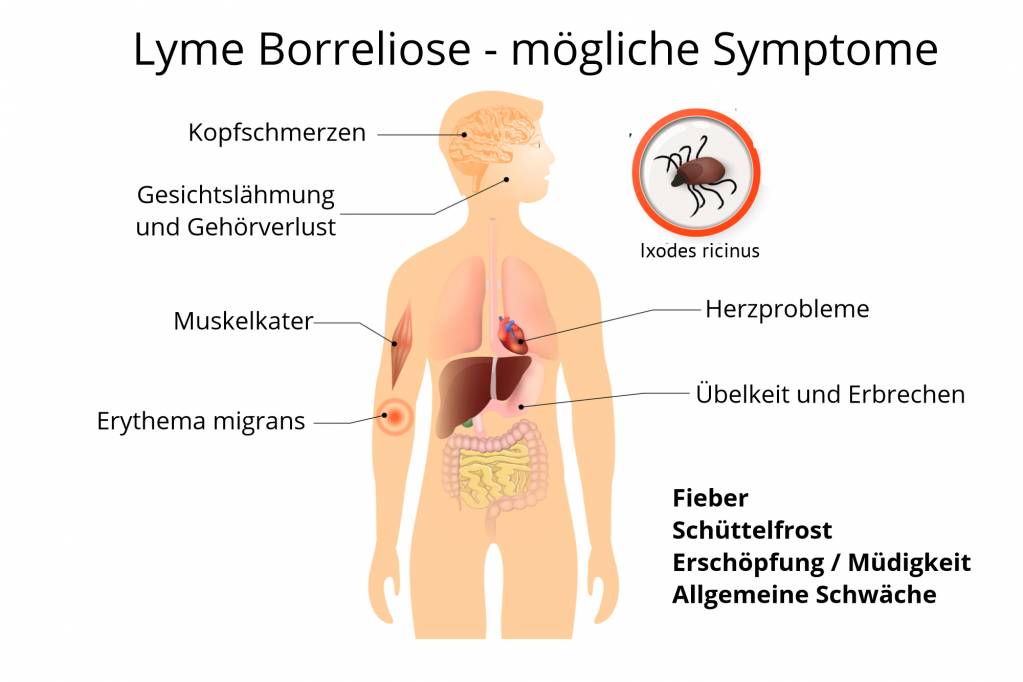 Verbreitung zeckenligach