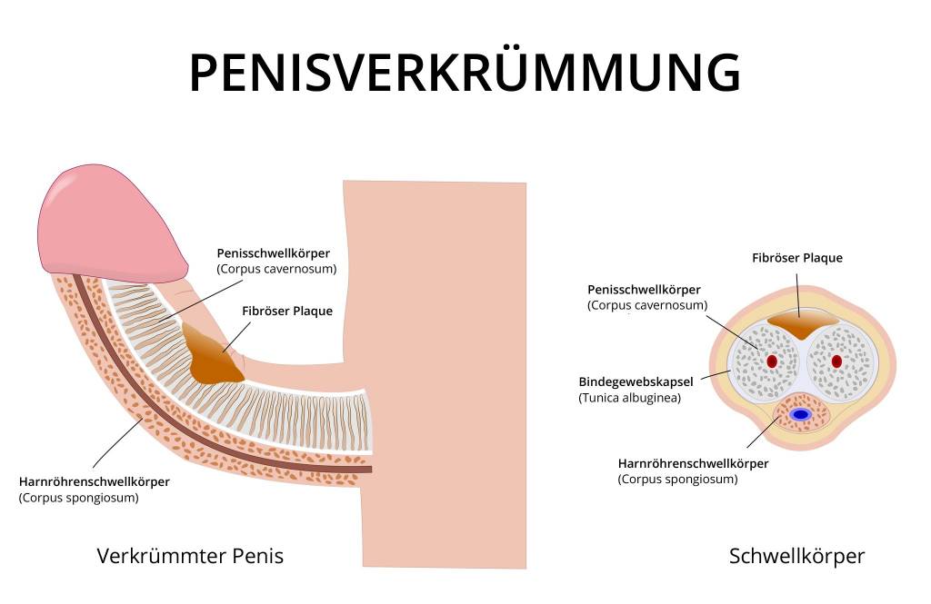 Penis schaft Penis head