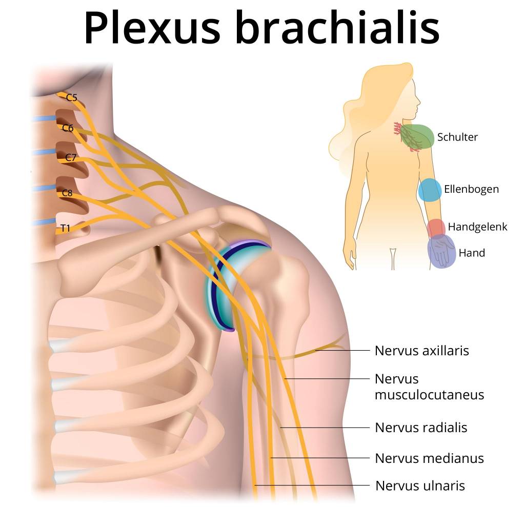 Brachialgie » Ursachen, Symptome, Behandlung, Prognose