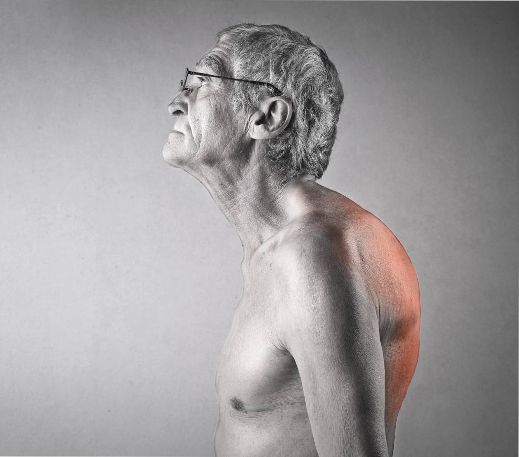Morbus Scheuermann » Ursachen, Symptome, Diagnose & Therapie