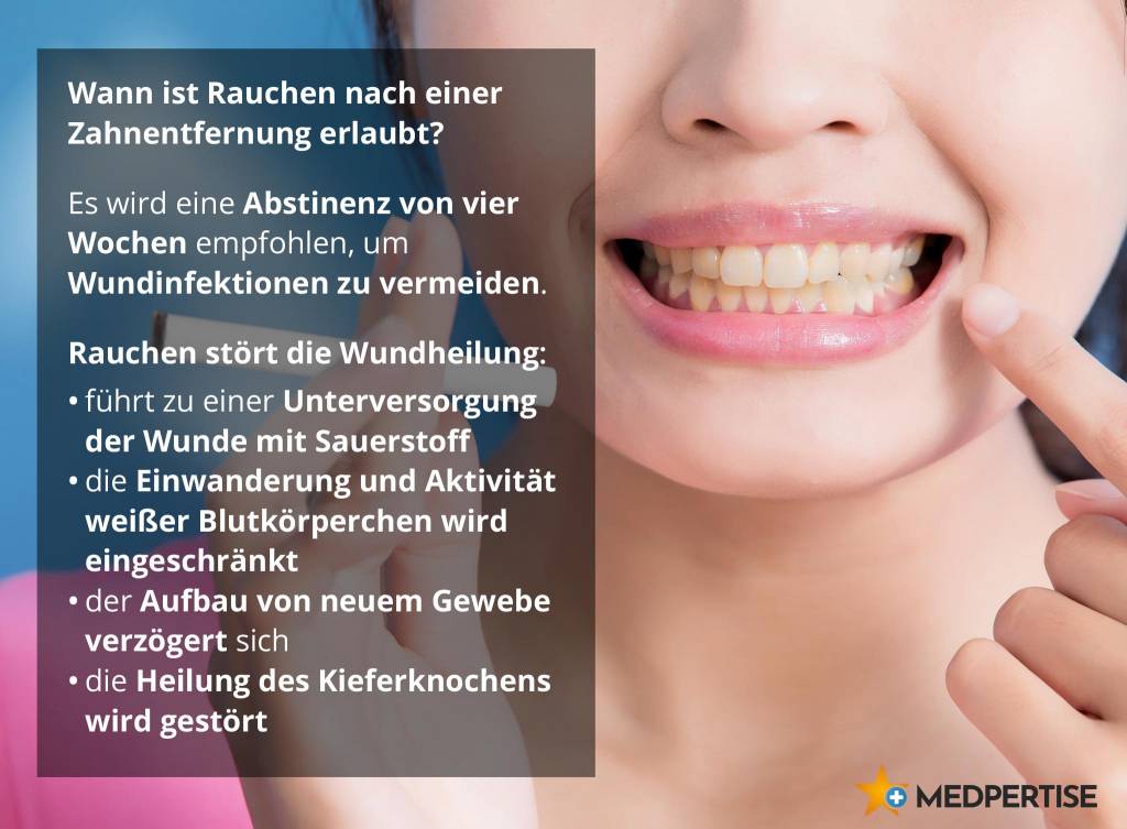 Wann ist Rauchen nach einer Zahnentfernung wieder erlaubt?