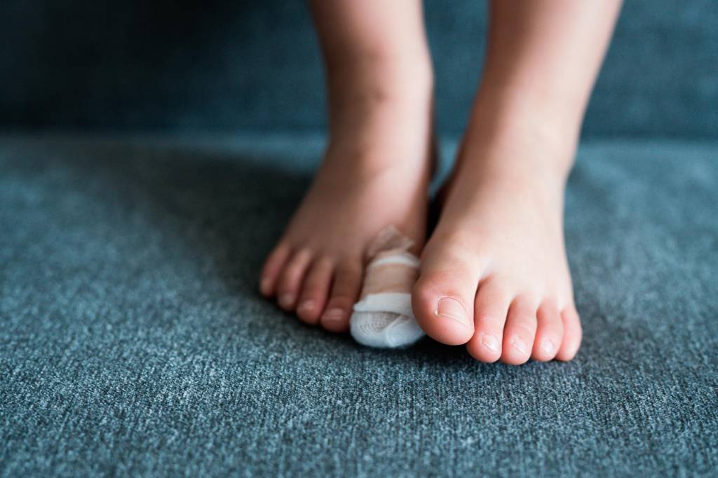 Gebrochen wie gips fuß lange Sprunggelenkbruch