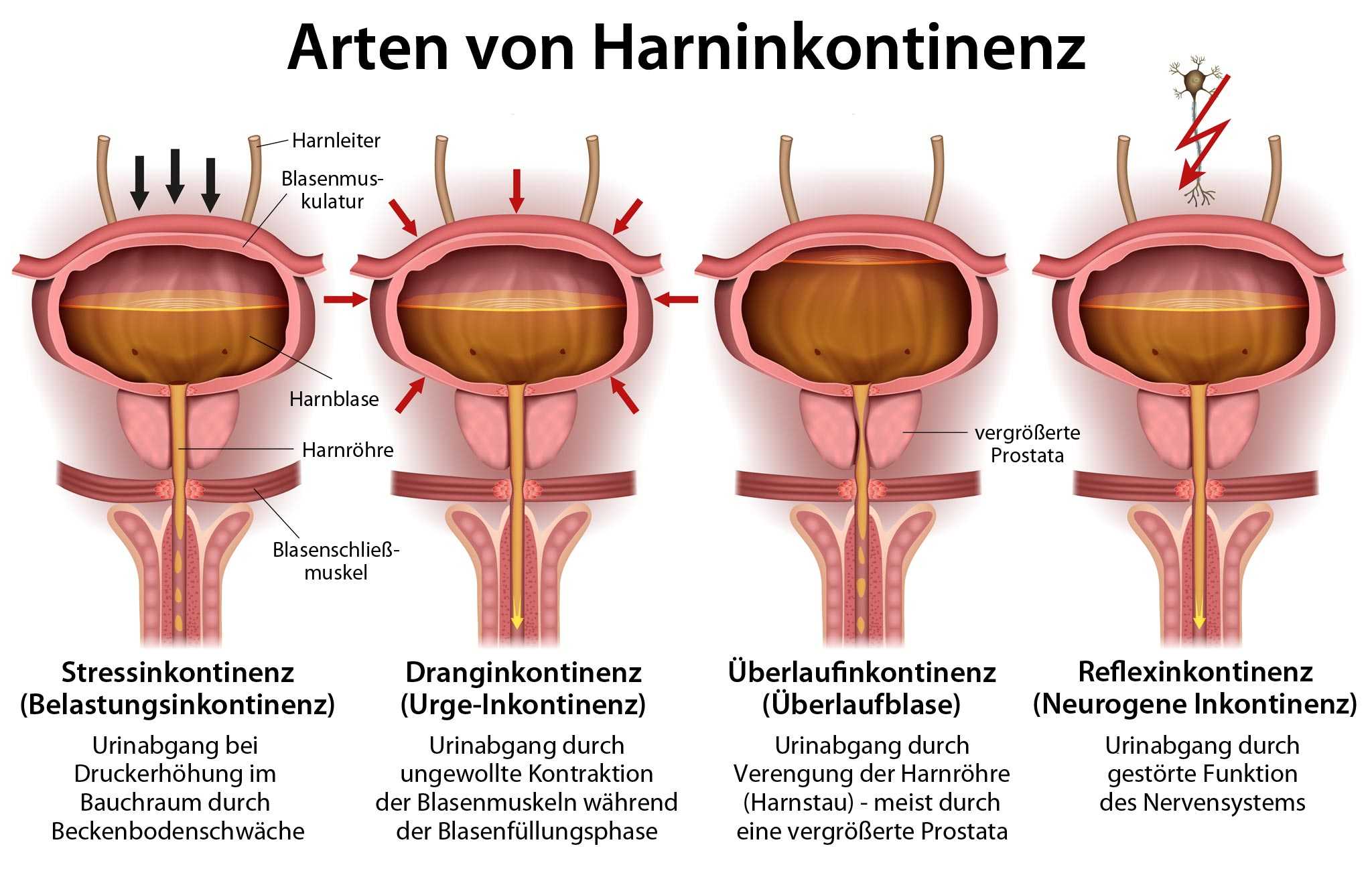 Der frau bei prostata Prostatamassage: Einfache