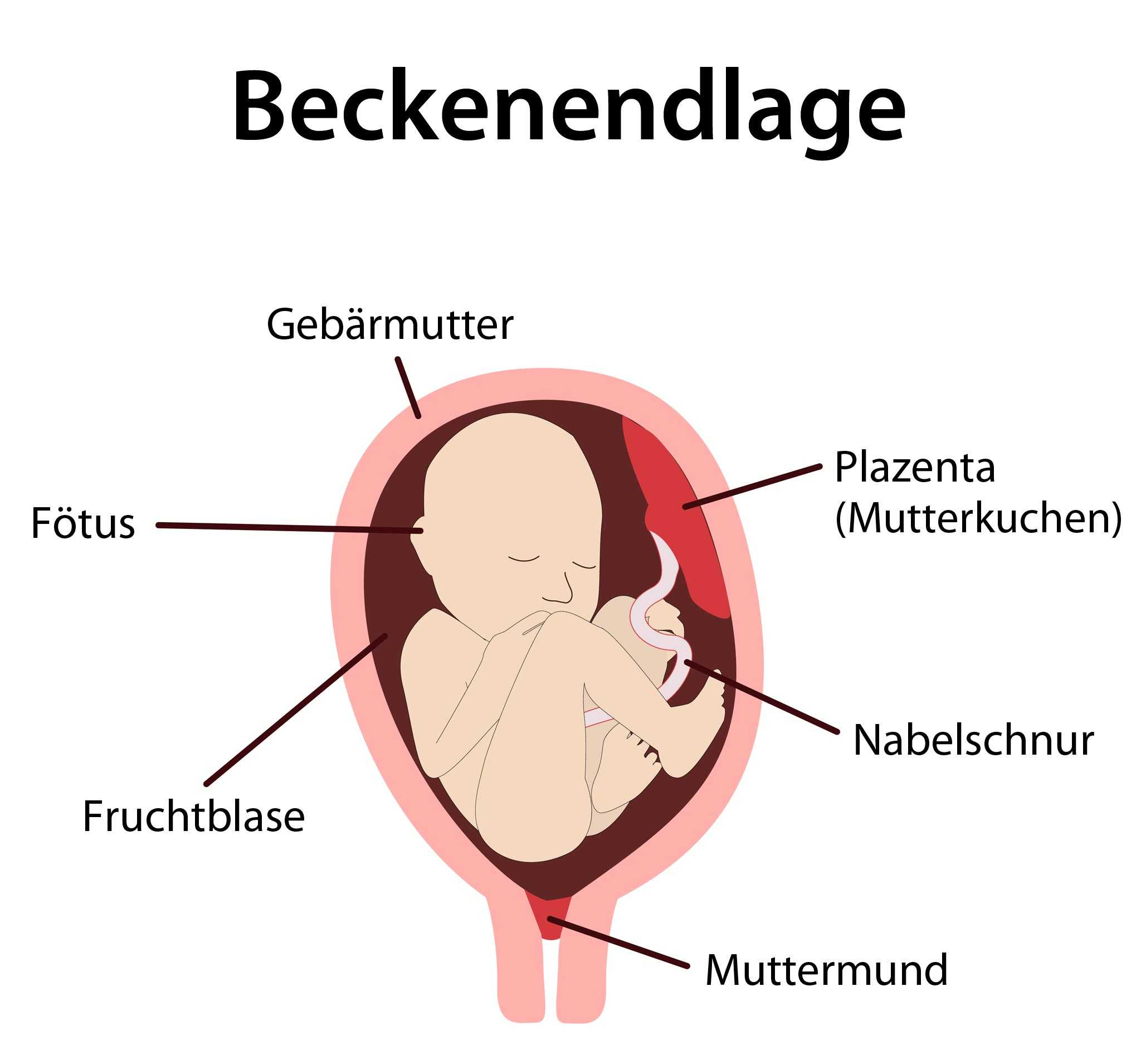 Beckenendlage