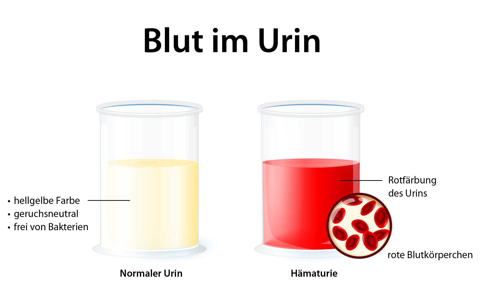 Nach urinieren läuft urin nach mann