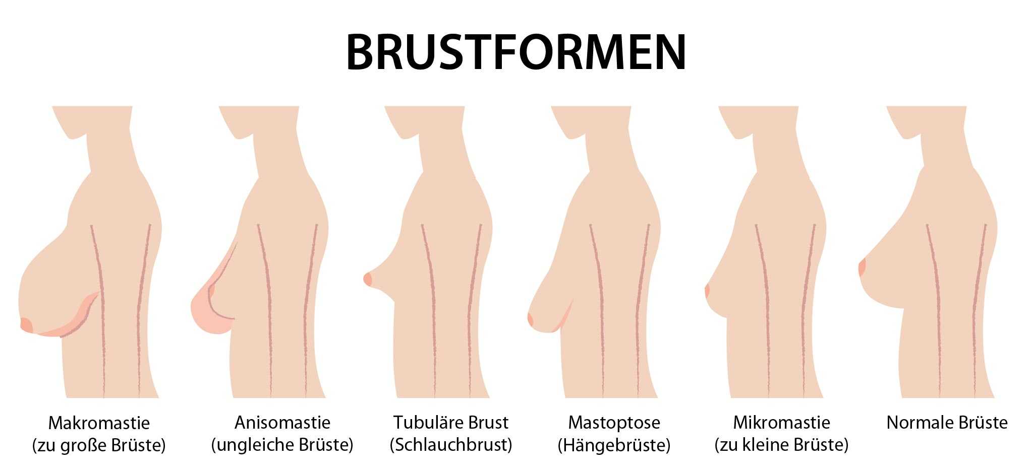 Große brüste ungleich Ungleich große