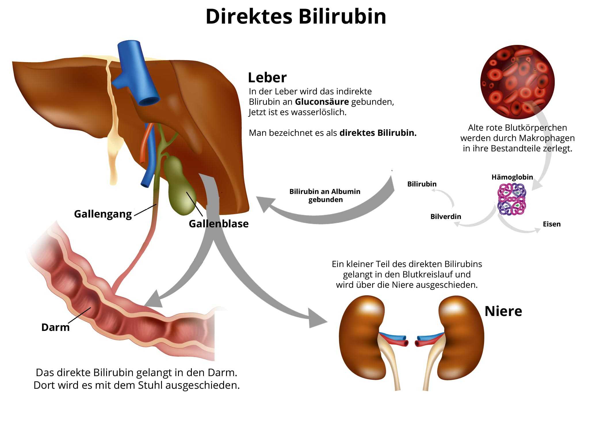 összbilirubin