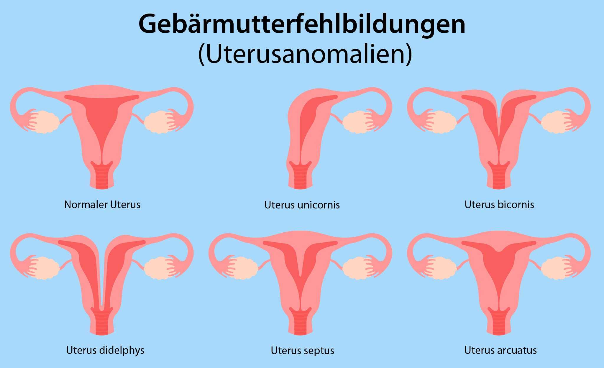 Schwangerschaft ohne ultraschall gebärmutter Kann man