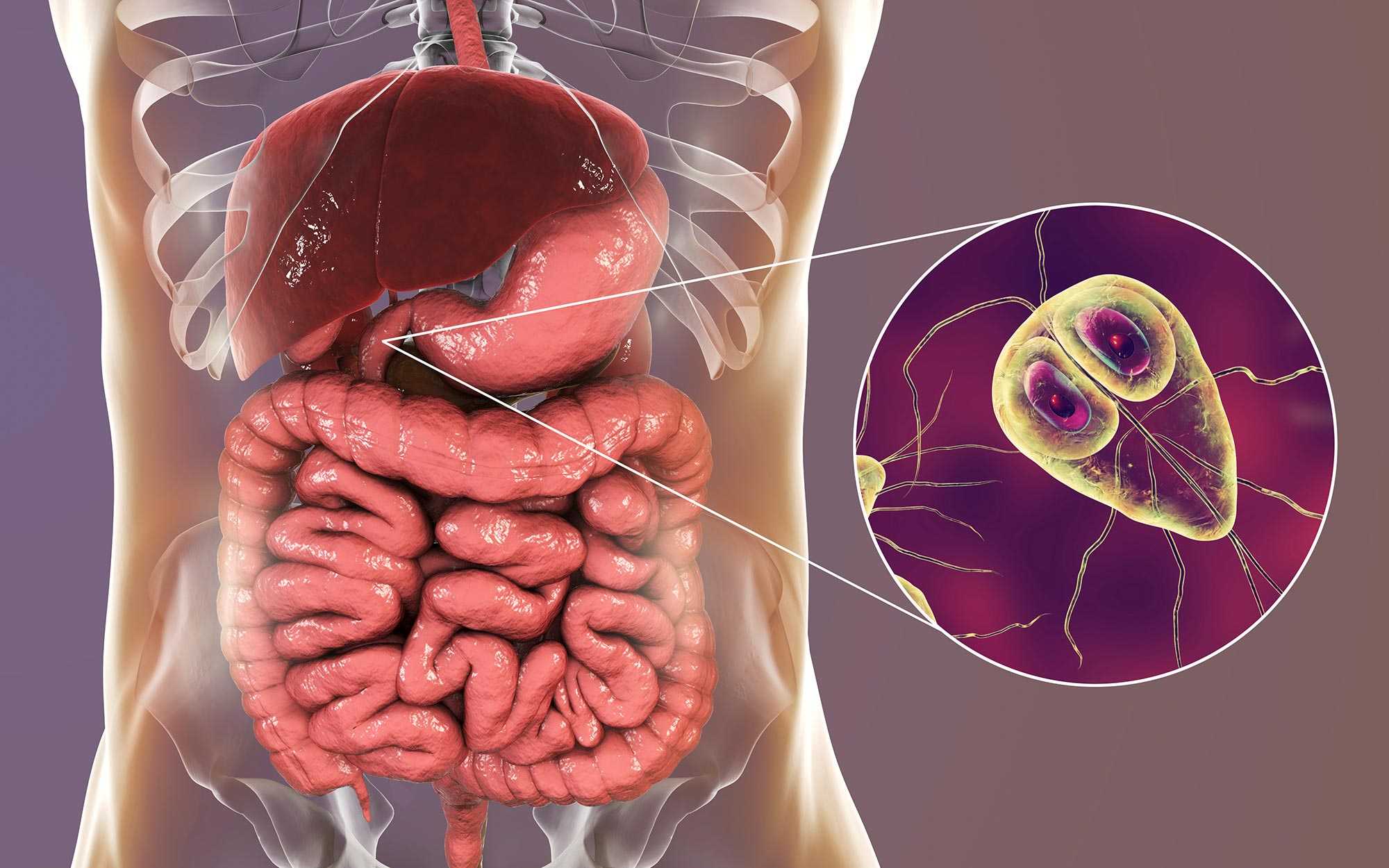Diagnosticul și tratamentul infecției cu Giardia Intestinalis – Lambliaza, Infecția giardiei