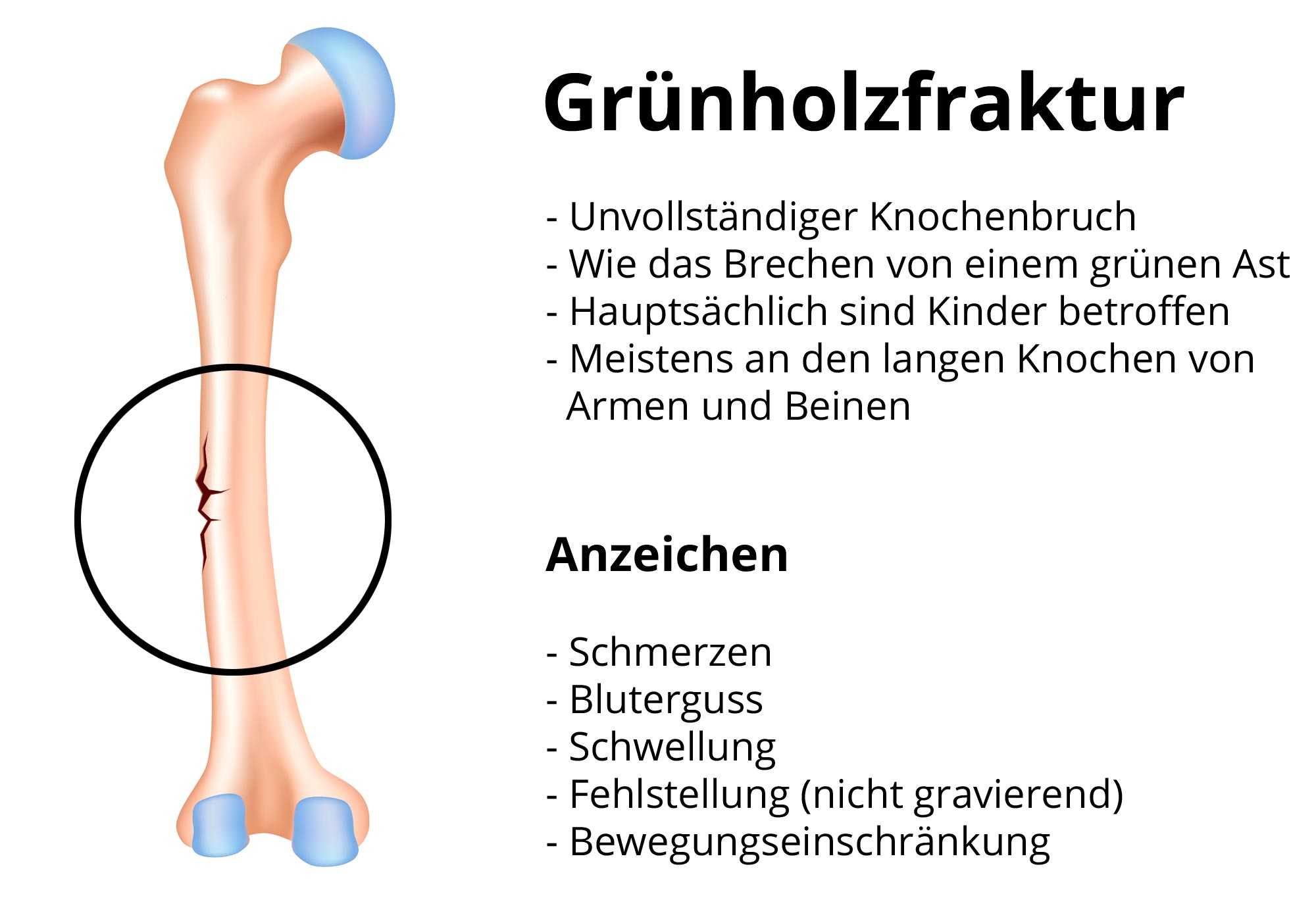 Finger sich den schnell wie kann brechen man Tricks zum