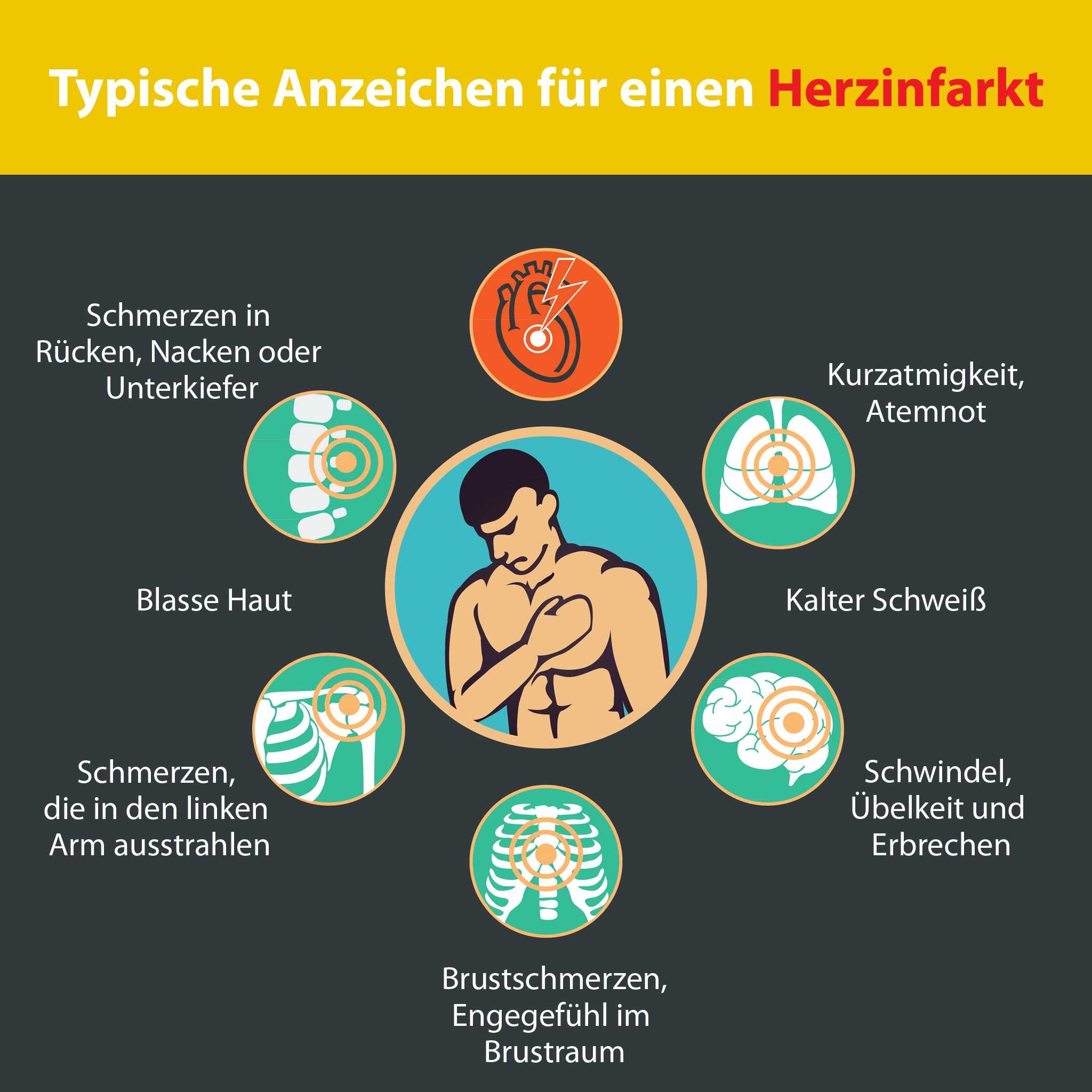 Und hand arm schmerzen Nervenschmerzen im