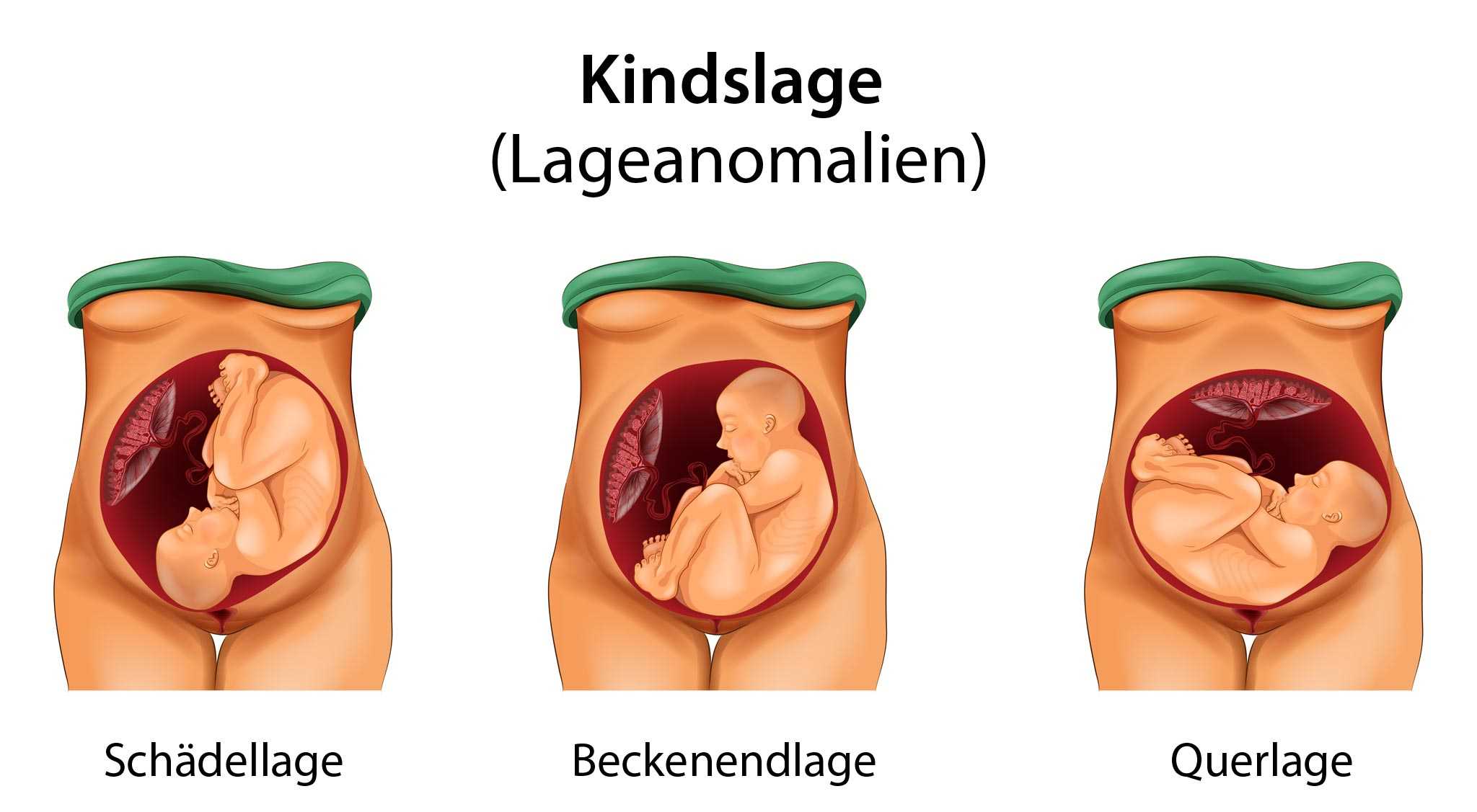 Baby querlage Baby Q