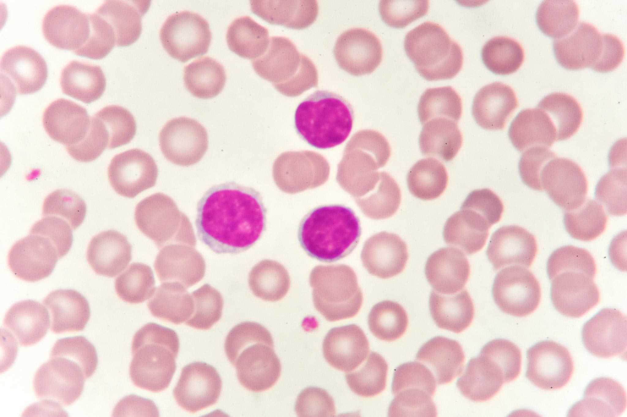 Lymphozyten