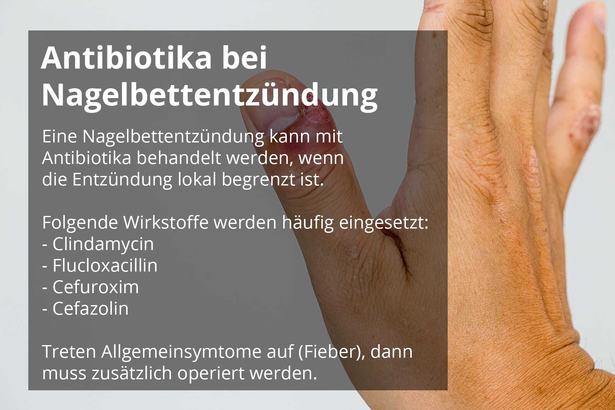 Operation nagelbettentzündung Nagelentzündung »