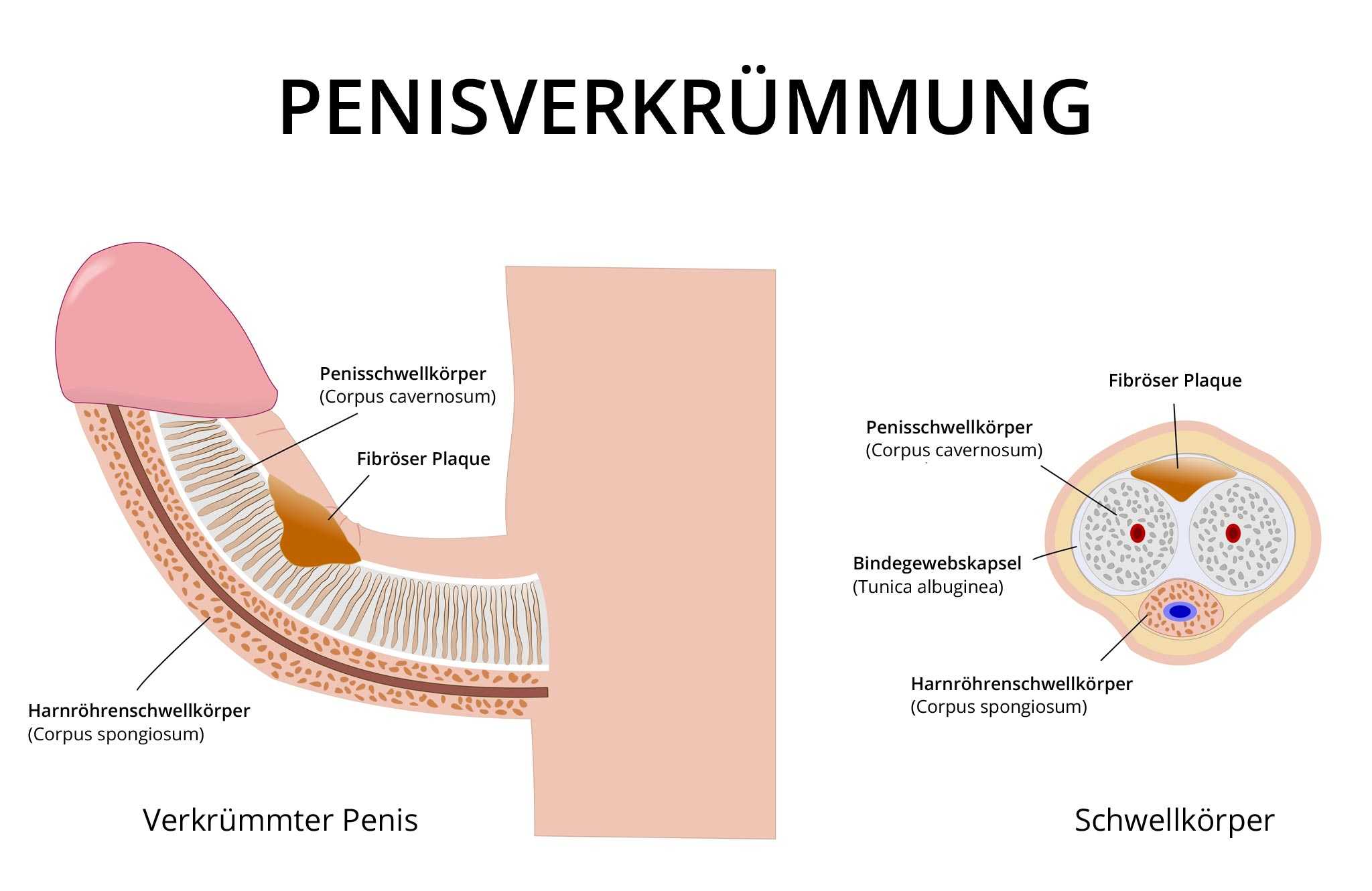 Oben penis nach Penis nach