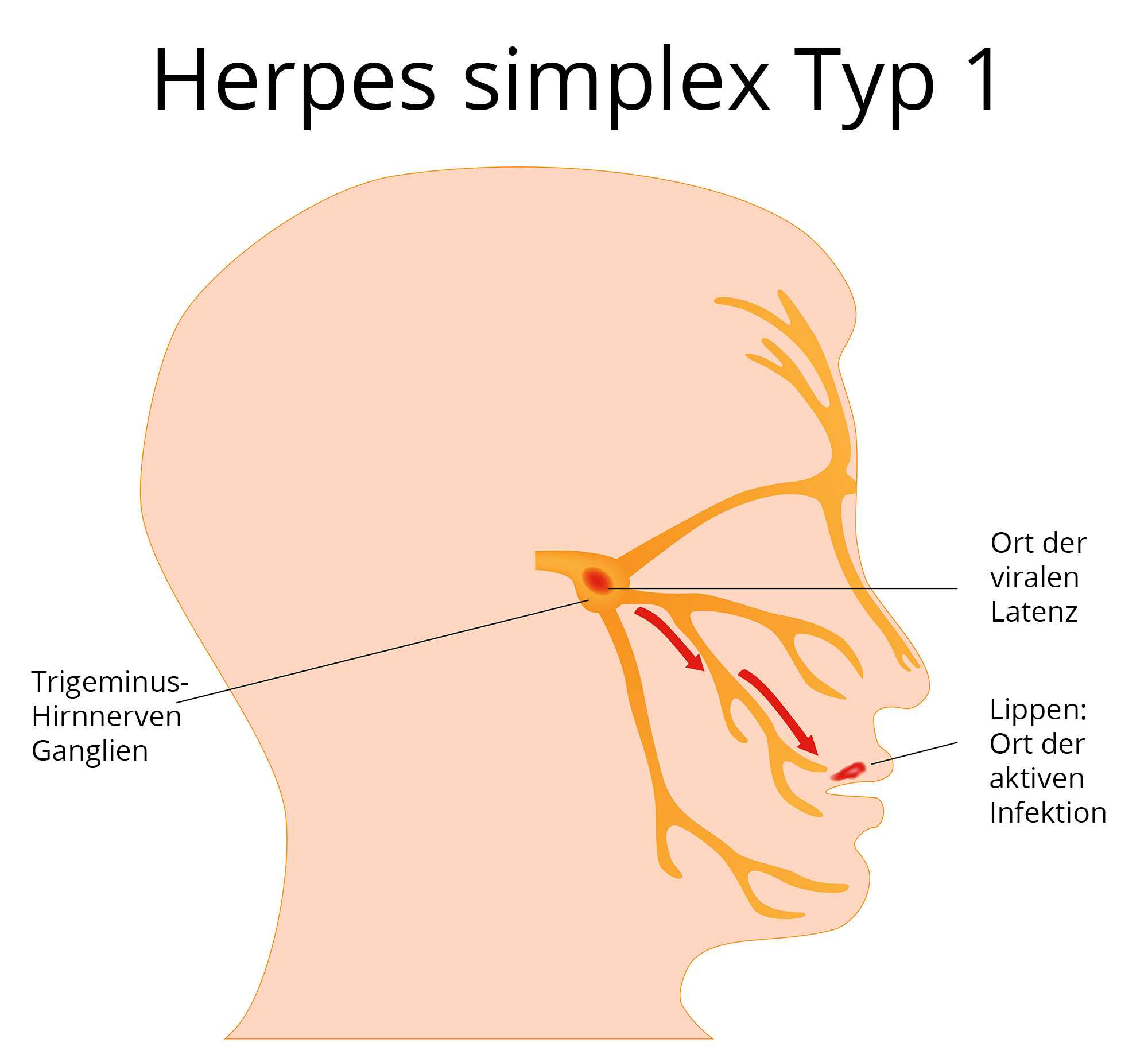 Herpes infektion im intimbereich