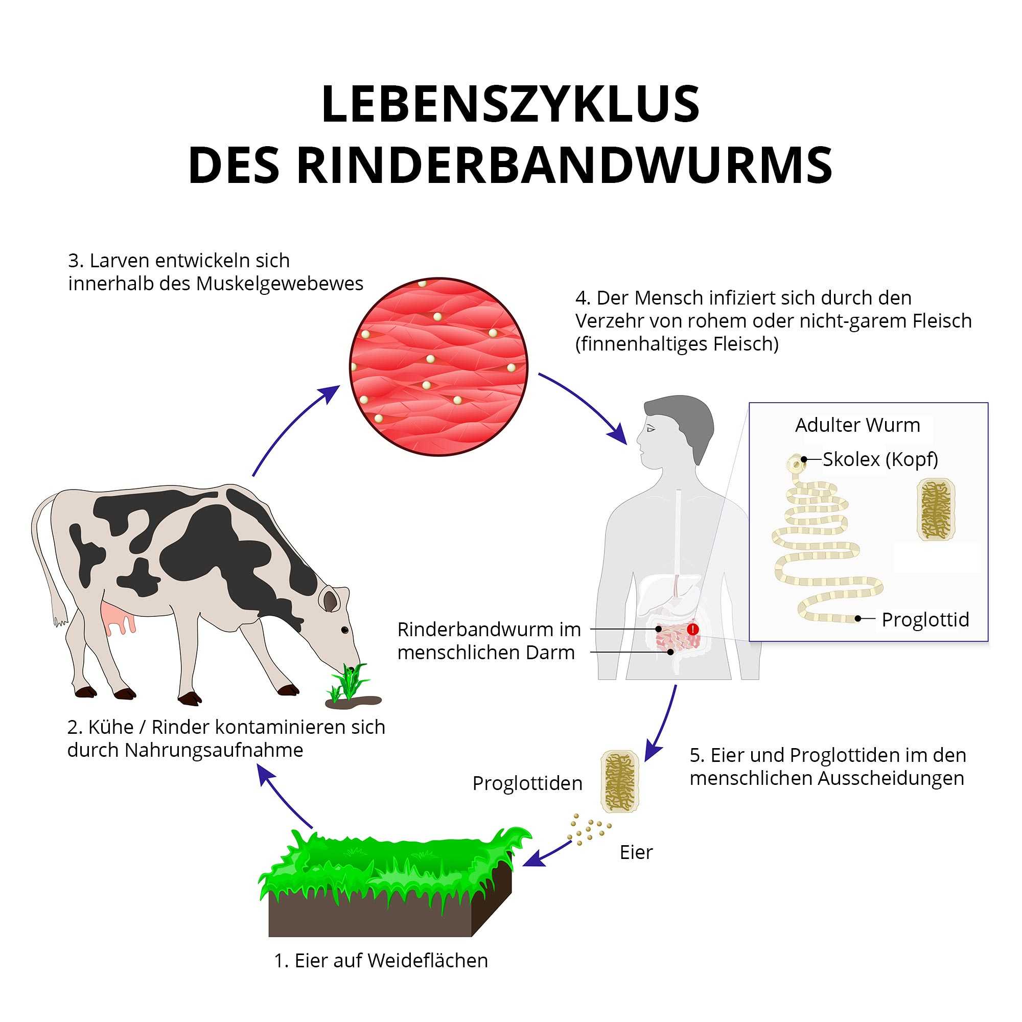 Bandwurmer Cestoden Ansteckung Symptome Behandlung