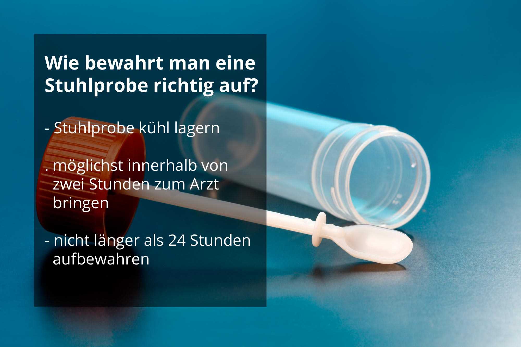 Kann Stuhlprobe vom Vortag sein?