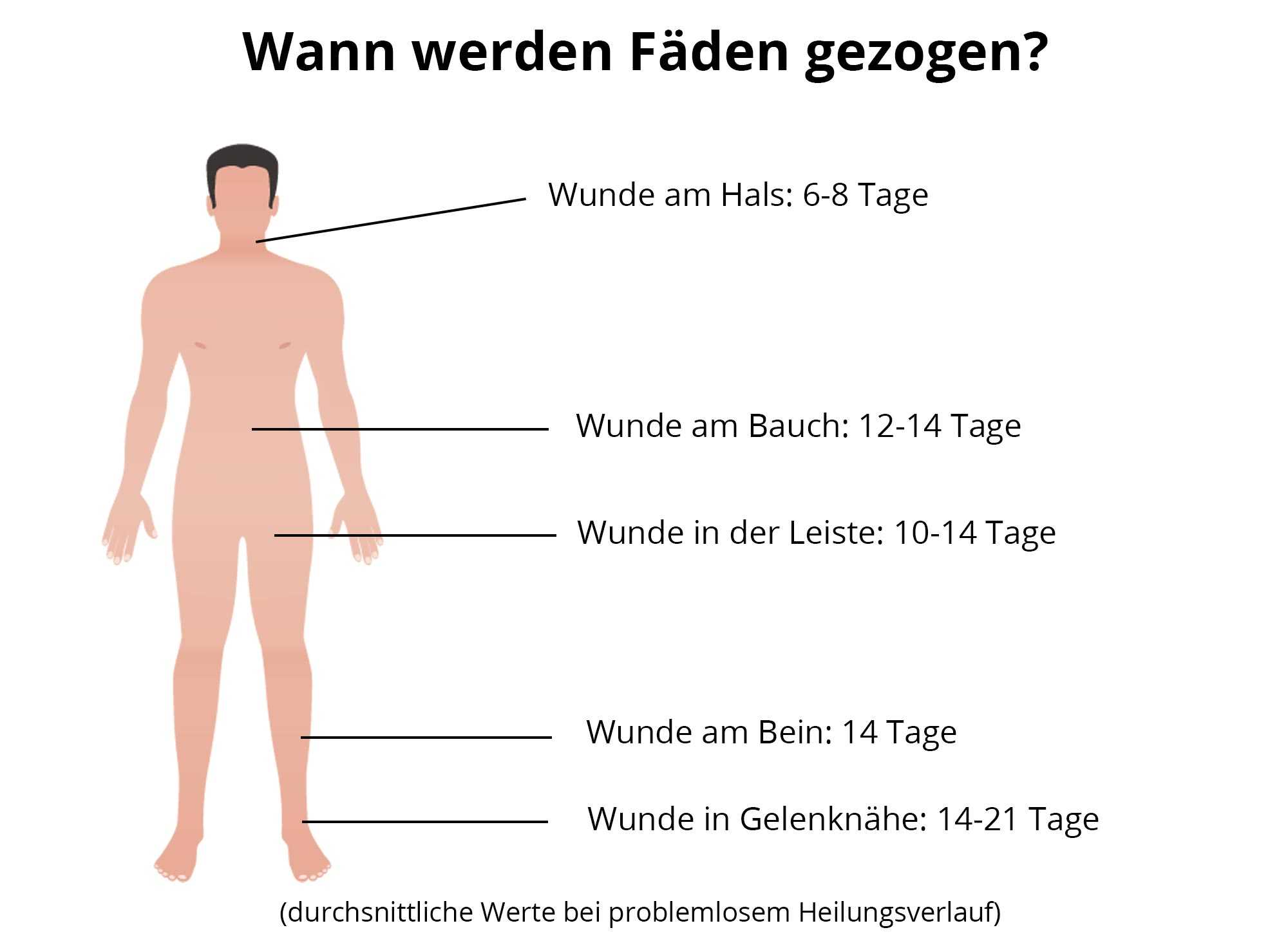 Ziehen knie fäden Fäden ziehen