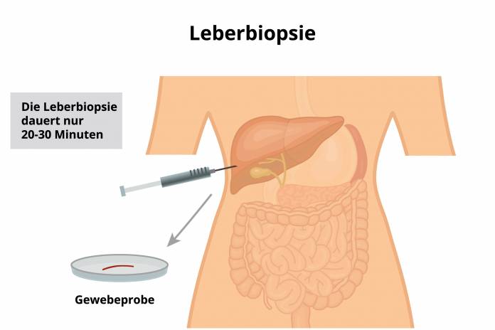 Leberbiopsie