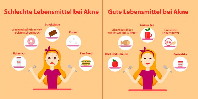 Ernährung bei Akne