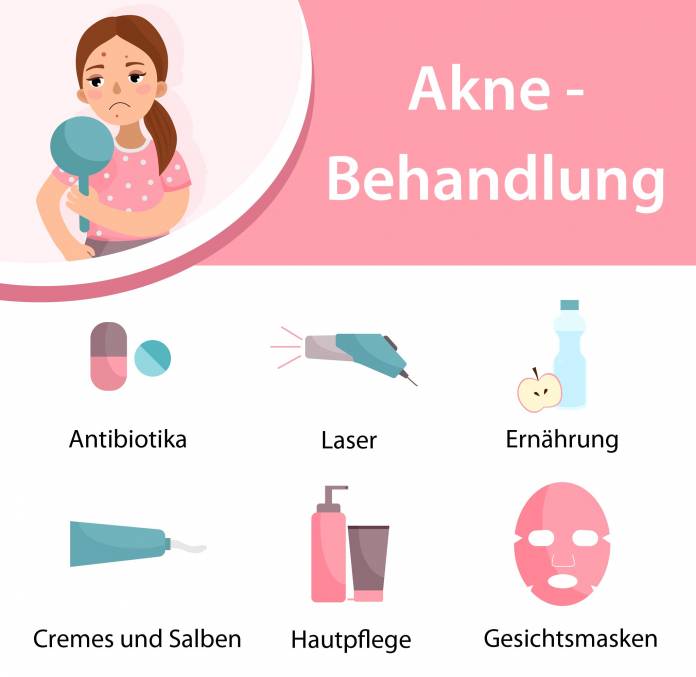 Behandlung von Akne