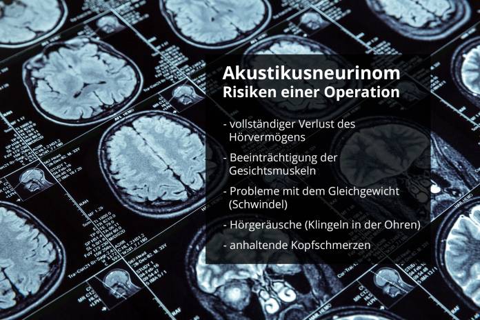 Akustikusneurinom - Risiken einer Operation