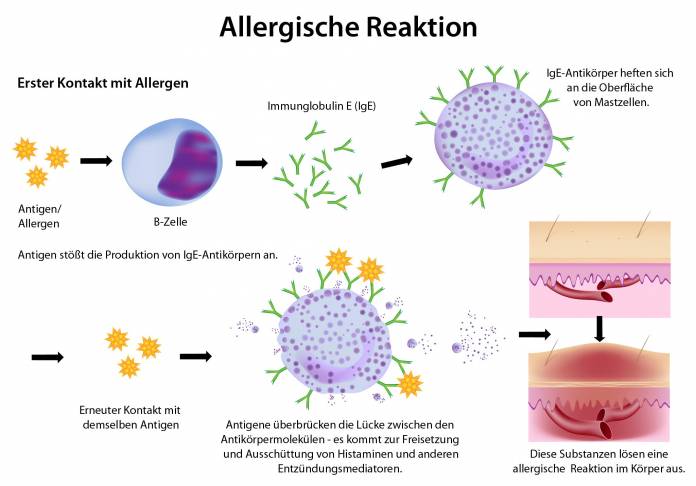 Allergische Reaktion