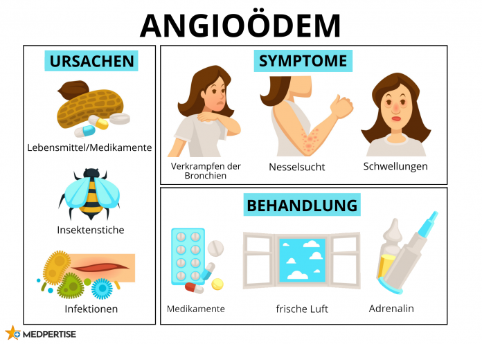 Ursachen, Symptome und Behandlung des Angioödems