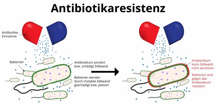 Antibiotikaresistenz