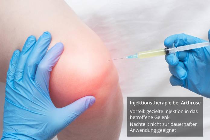 Arthrose Injektionsbehandlung