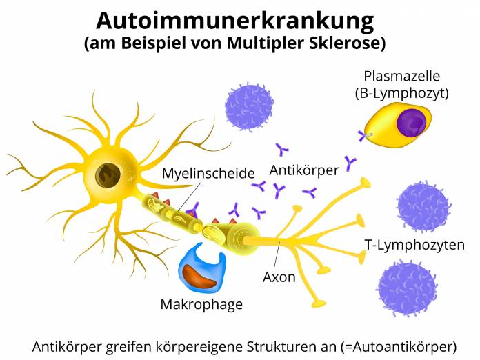 Autoimmunerkrankung