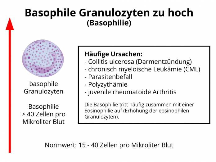 Basophile Granulozyten zu hoch