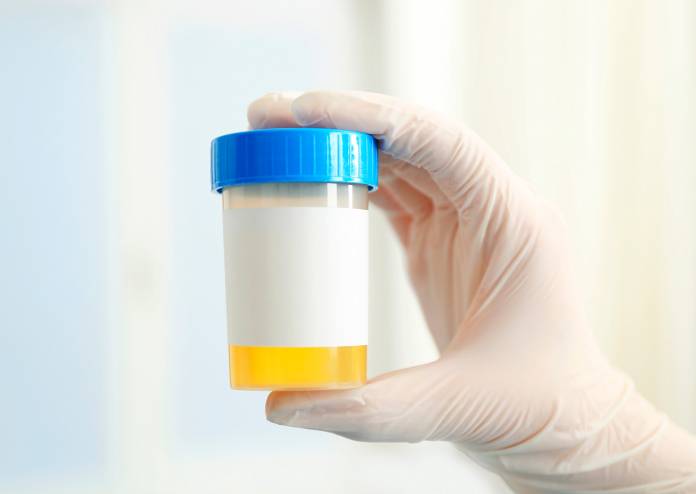 Blut im Urin » Ursachen, Symptome und Behandlung