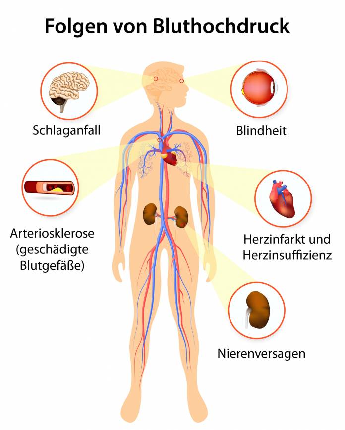 Folgen von Bluthochdruck