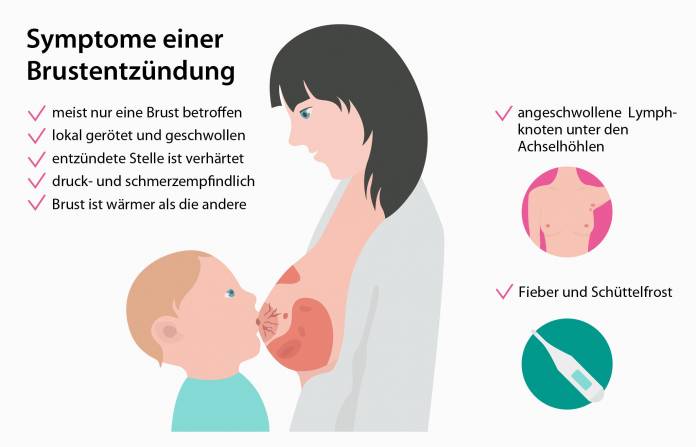 Symptome einer Brustentzündung