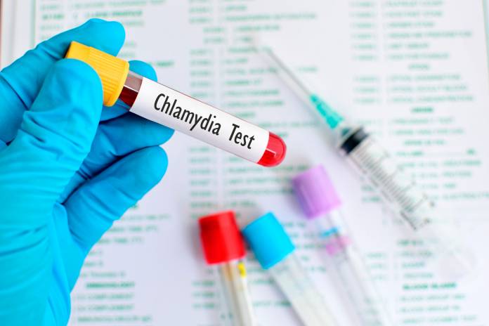Chlamydophila Pneumoniae Chlamydia Pneumoniae