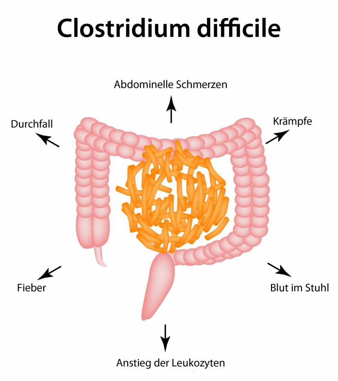 Clostridium difficile