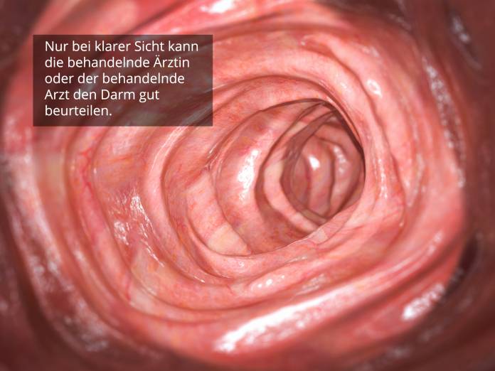 Darmreinigung - klare Sicht