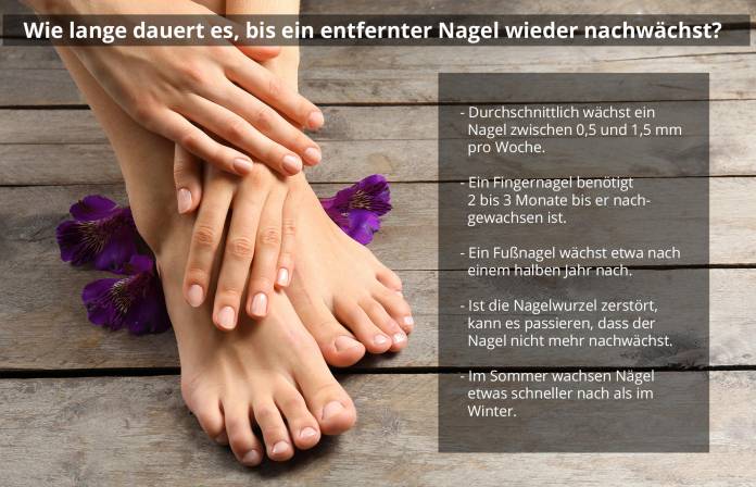 Dauer des Nagelwachstums nach Nagelentfernung