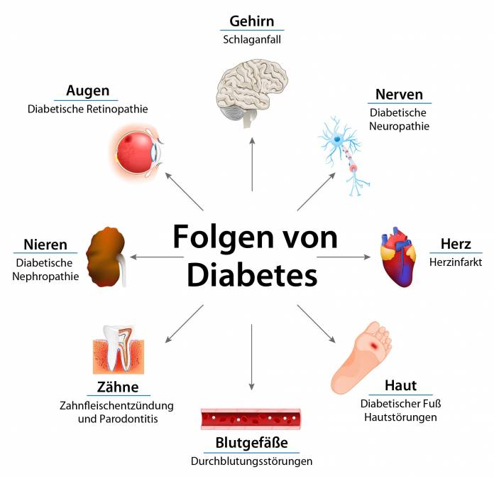 Folgeerkrankungen von Diabetes