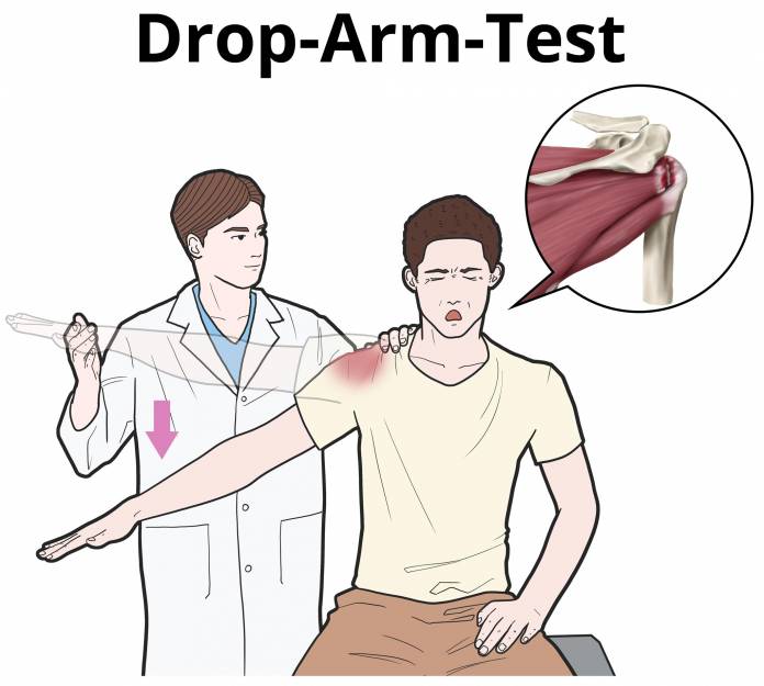 Drop-Arm-Test